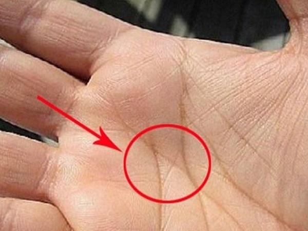 Ý nghĩa chung của chỉ tay chữ X trong lòng bàn tay