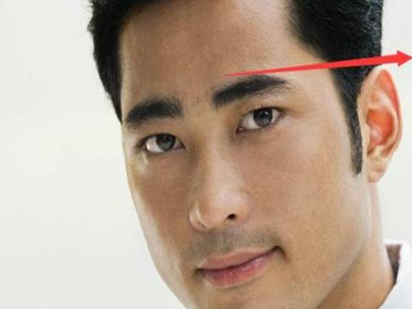 Tai thấp hơn lông mày