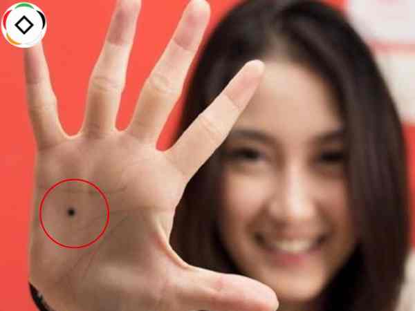 nốt ruồi lòng bàn tay phải