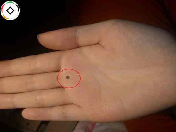 nốt ruồi lòng bàn tay phải