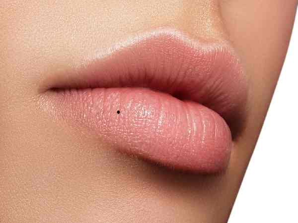 nốt ruồi môi dưới