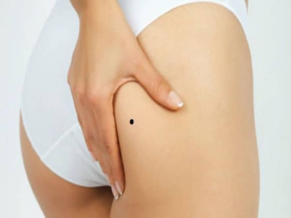 7 nốt ruồi ở mông ở nữ giới