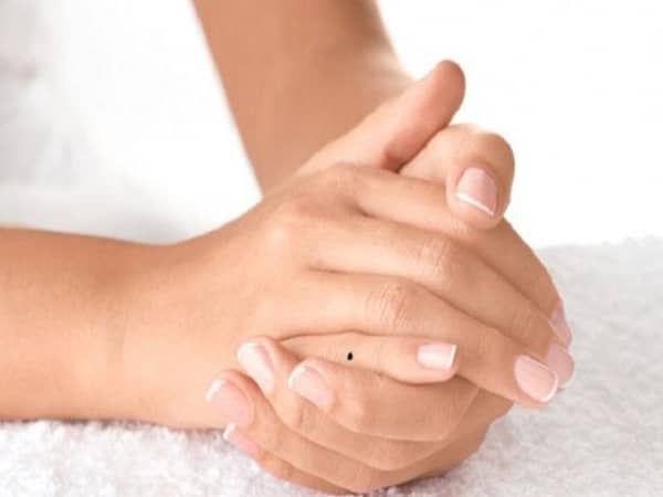 Có nốt ruồi ở ngón tay tốt hay xấu