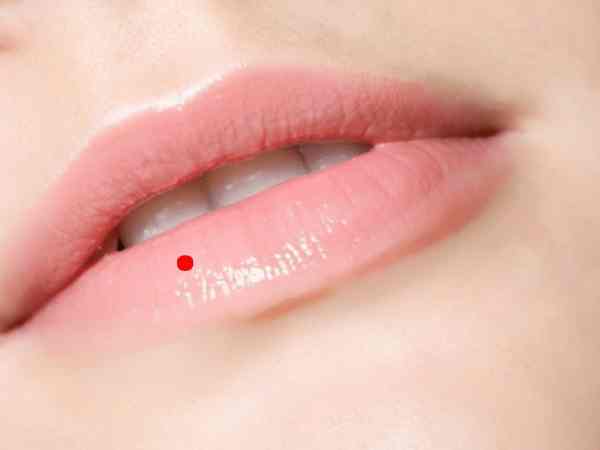 Nốt ruồi môi dưới nữ giới