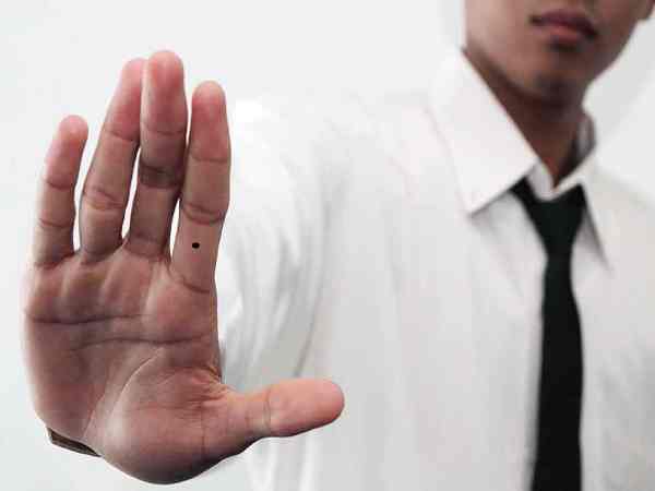 Nốt ruồi ở ngón tay trỏ