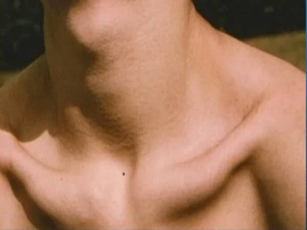 Ý nghĩa nốt ruồi ở hõm cổ nam giới