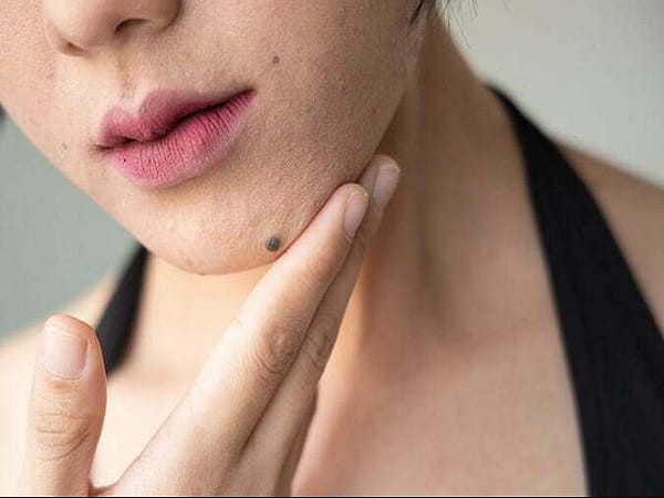 Ý nghĩa nốt ruồi dưới cằm nữ