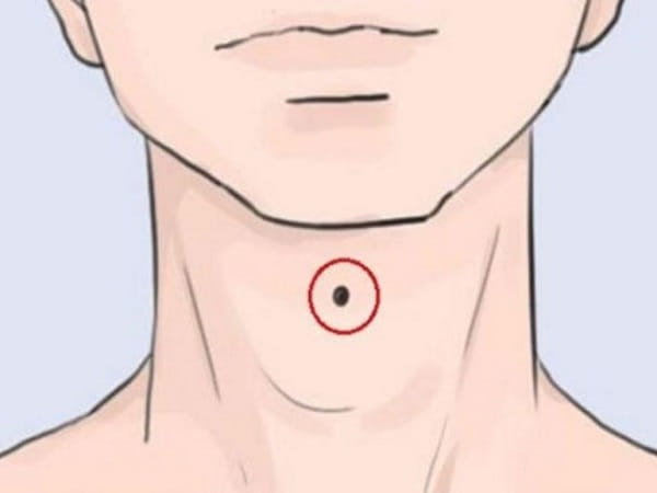 Nốt ruồi ở giữa cổ nam – Trí tuệ, bản lĩnh và giàu nghị lực