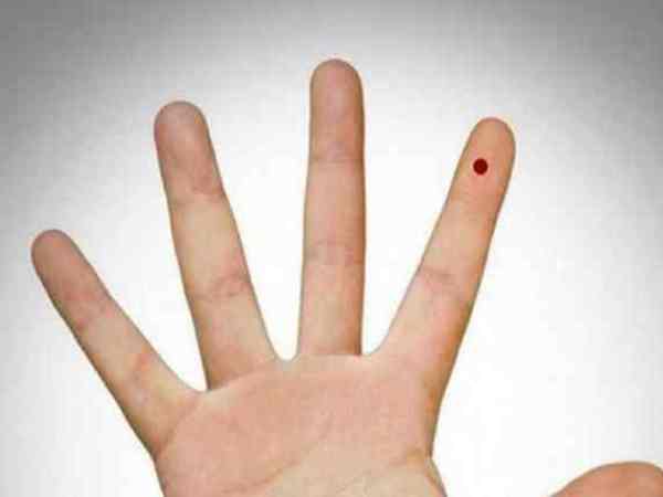 Nốt ruồi son ở ngón tay trỏ Mụn ruồi son tay