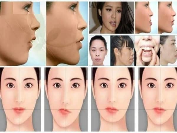 Luận tướng mặt lệch và vận mệnh theo phong thủy tâm linh